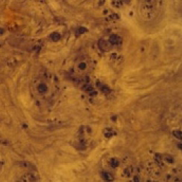 Castellana de Ascensores Valladolid